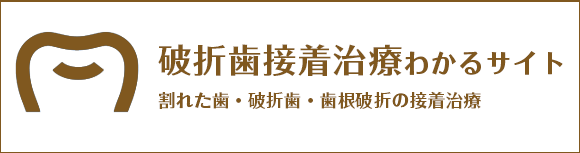 破折歯接着治療かわるサイト 割れた歯・破折歯・歯根破折の接着治療